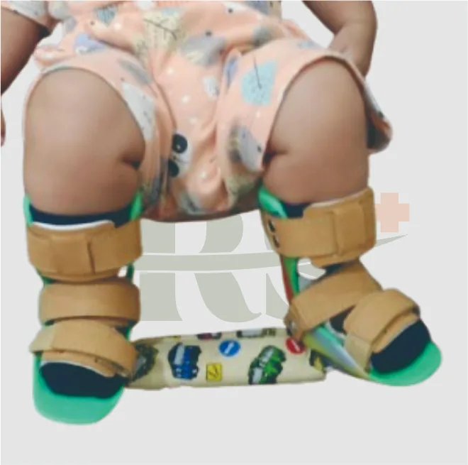 DBS Splint